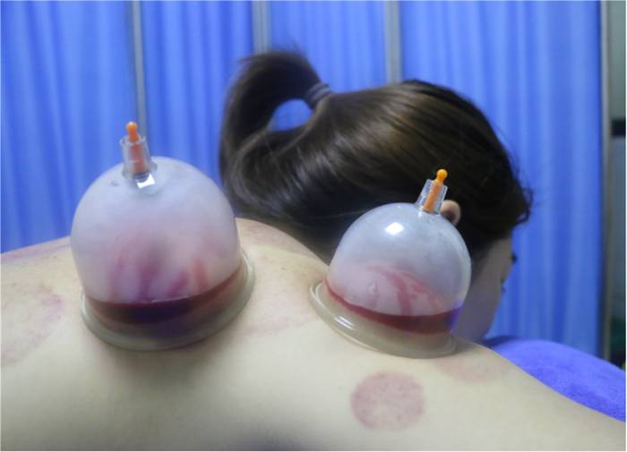 1591266555284440.png 1591266555284440.png